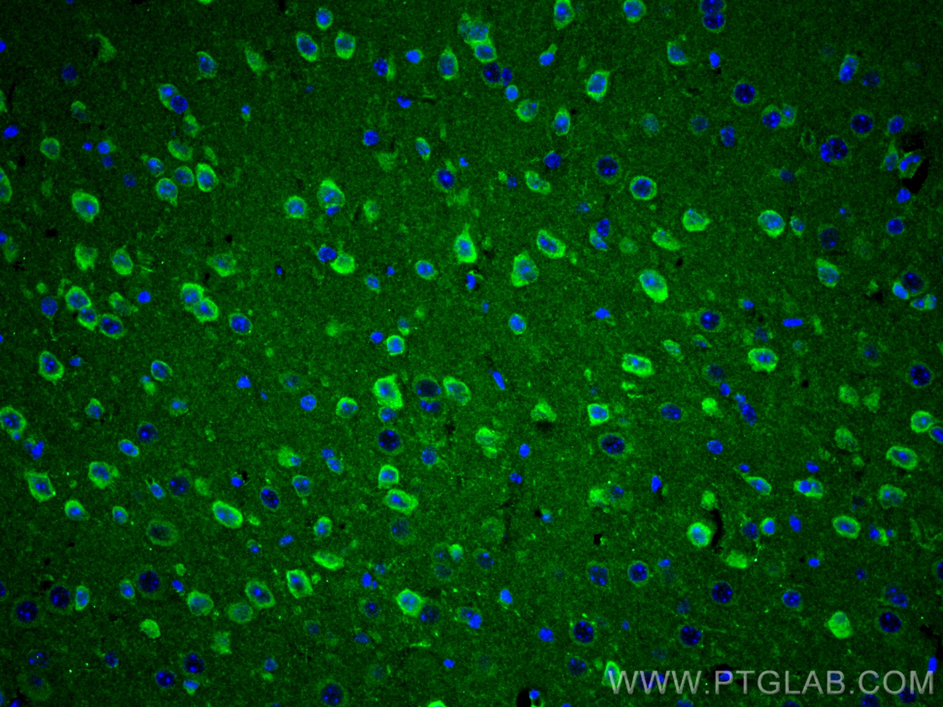 Immunofluorescence (IF) / fluorescent staining of mouse brain tissue using Cathepsin K Polyclonal antibody (11239-1-AP)