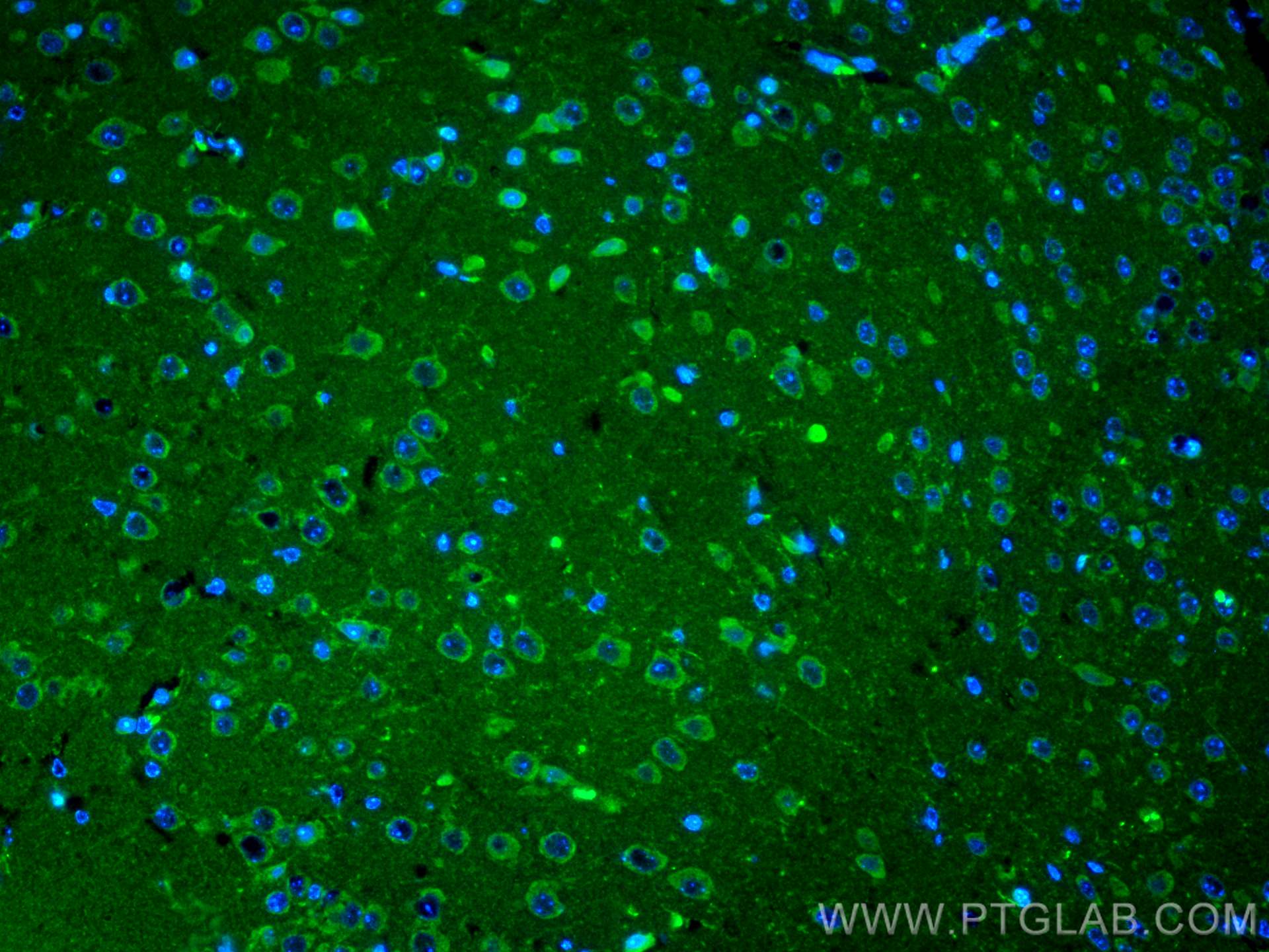 Cathepsin K