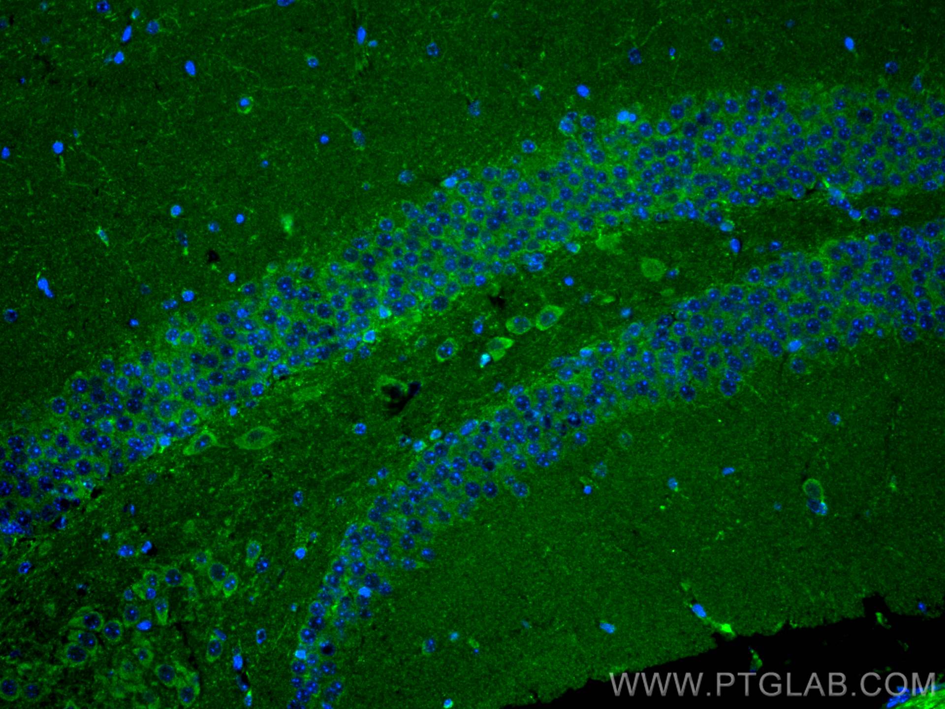 Immunofluorescence (IF) / fluorescent staining of mouse brain tissue using Cathepsin K Polyclonal antibody (11239-1-AP)