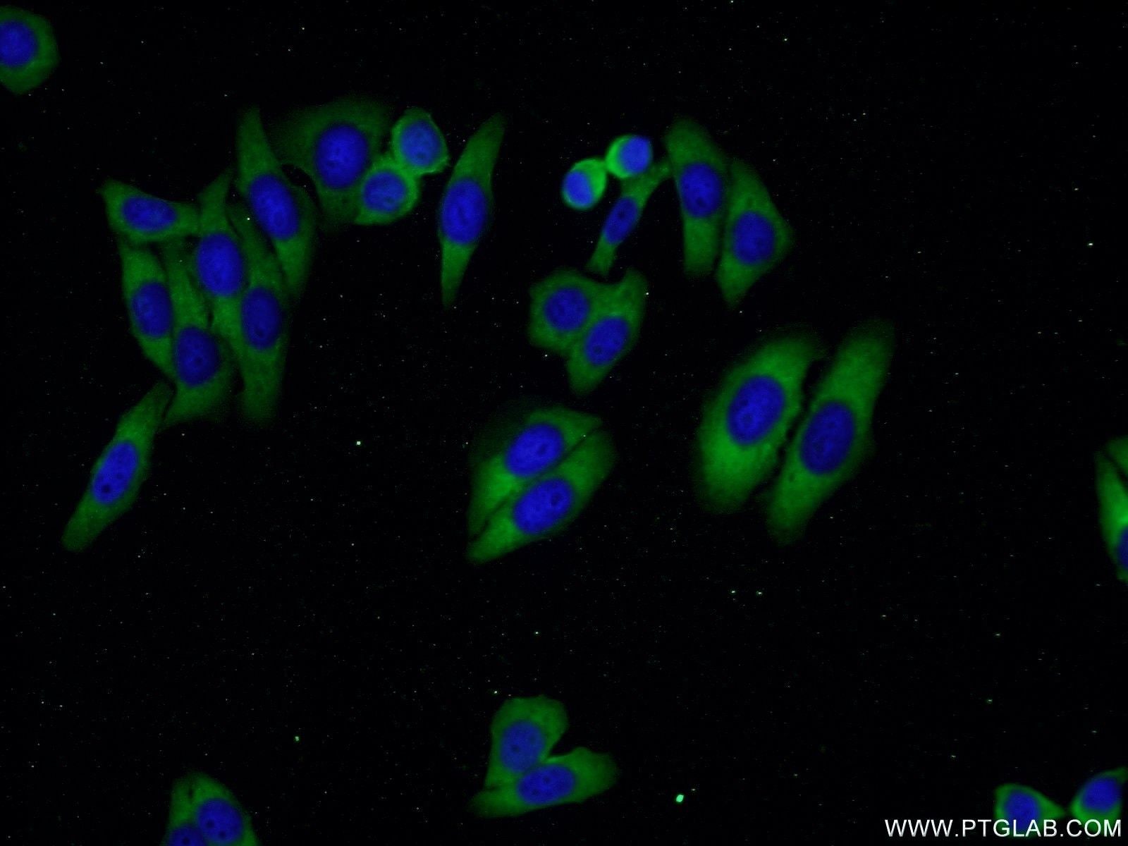 Immunofluorescence (IF) / fluorescent staining of HepG2 cells using Cathepsin K Polyclonal antibody (11239-1-AP)