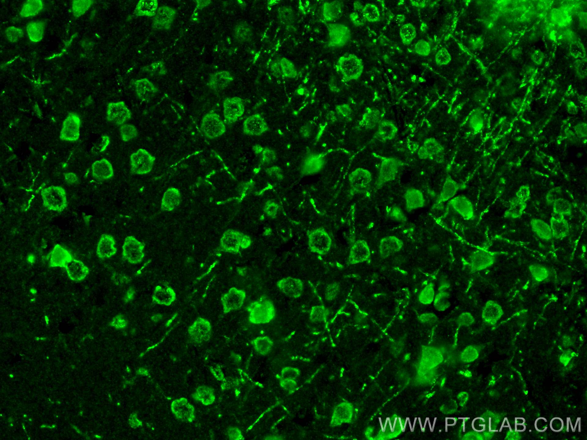 IF Staining of mouse brain using 11239-1-AP