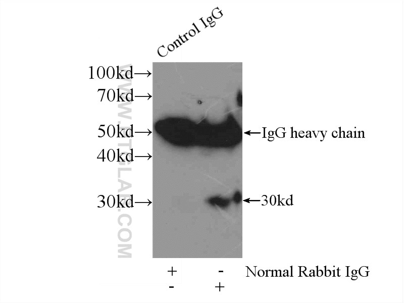 Immunoprecipitation (IP) experiment of ROS1728 cells using Cathepsin K Polyclonal antibody (11239-1-AP)