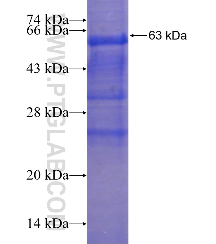 CTSK fusion protein Ag1761 SDS-PAGE