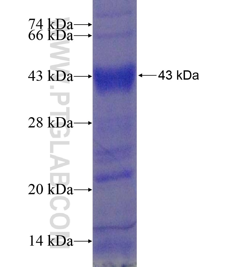 CTSK fusion protein Ag17904 SDS-PAGE