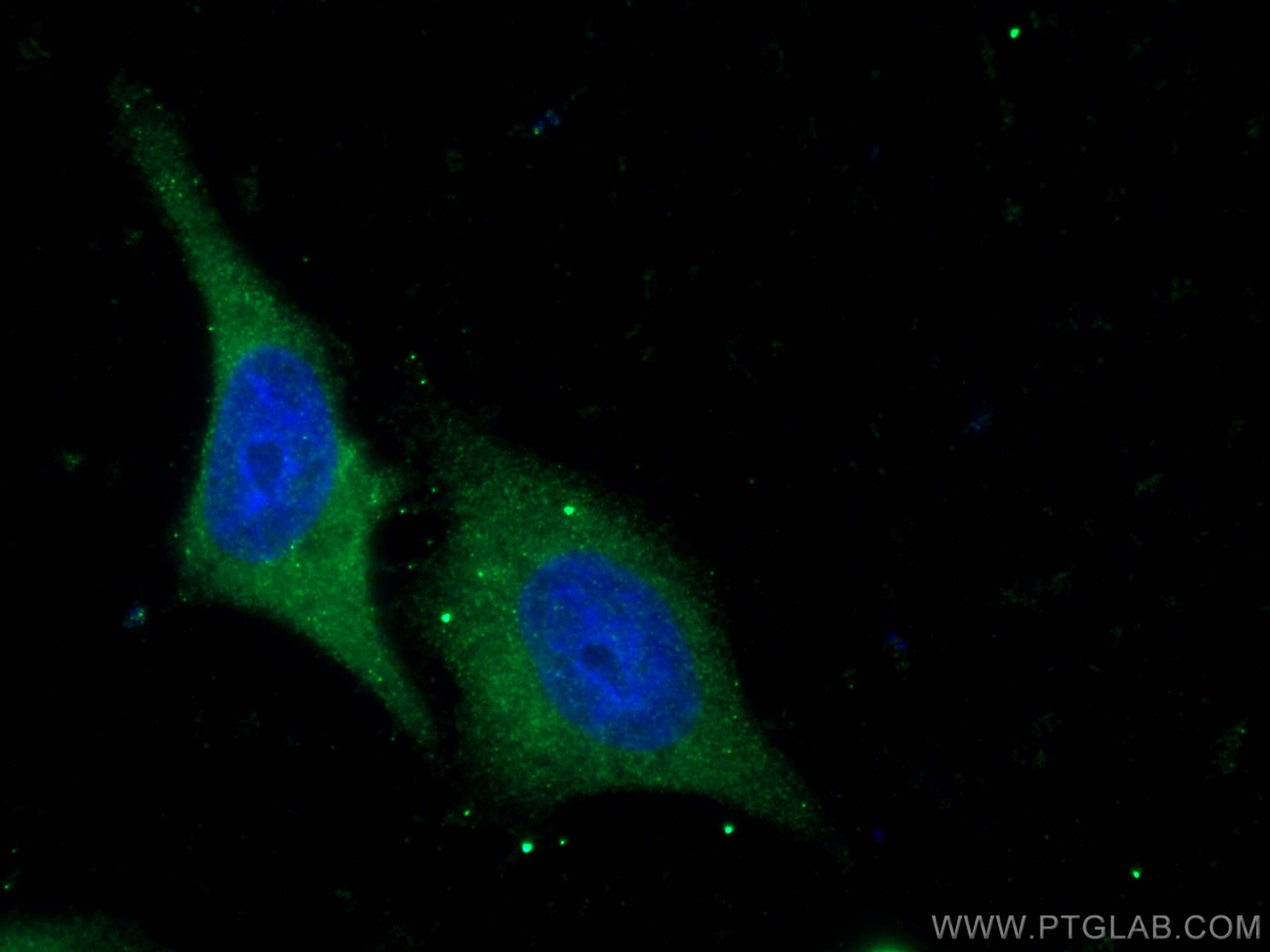 Immunofluorescence (IF) / fluorescent staining of HepG2 cells using Cathepsin L Polyclonal antibody (10938-1-AP)