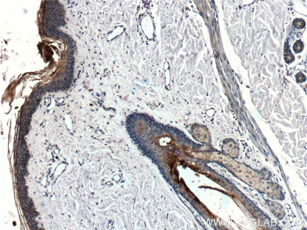 Immunohistochemistry (IHC) staining of human skin tissue using Cathepsin L Polyclonal antibody (10938-1-AP)
