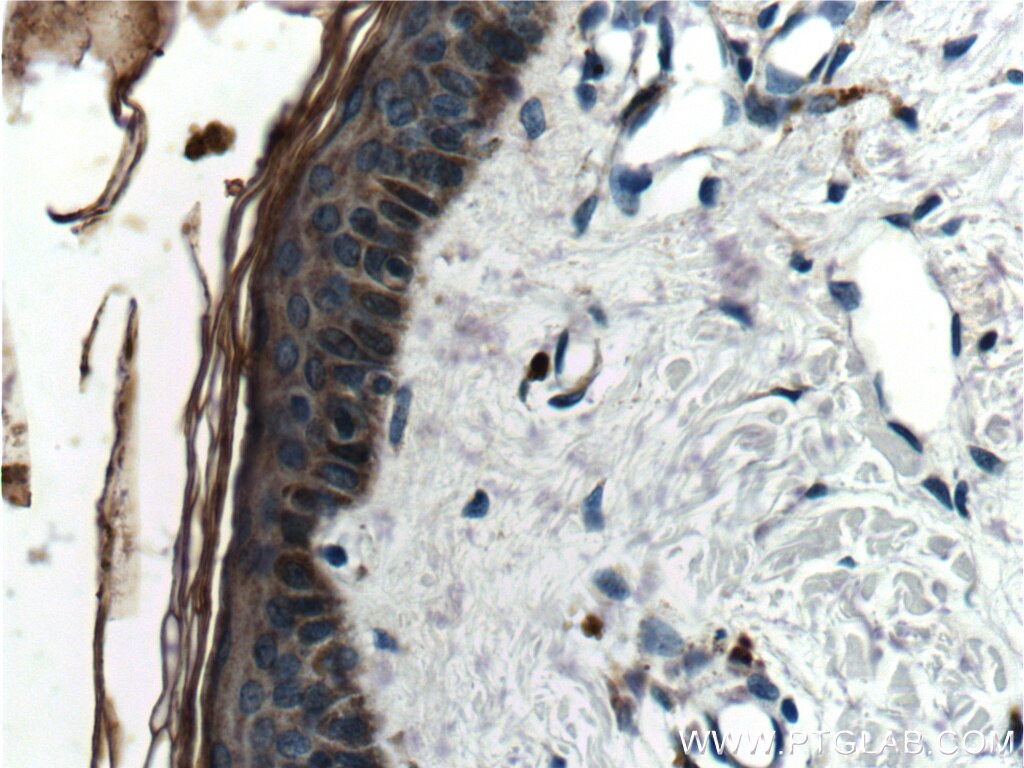 Immunohistochemistry (IHC) staining of human skin tissue using Cathepsin L Polyclonal antibody (10938-1-AP)