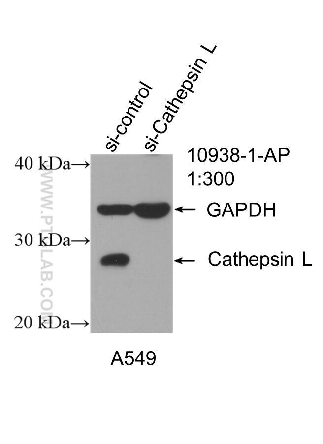 Western Blot (WB) analysis of A549 cells using Cathepsin L Polyclonal antibody (10938-1-AP)