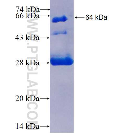 Cathepsin L fusion protein Ag1373 SDS-PAGE