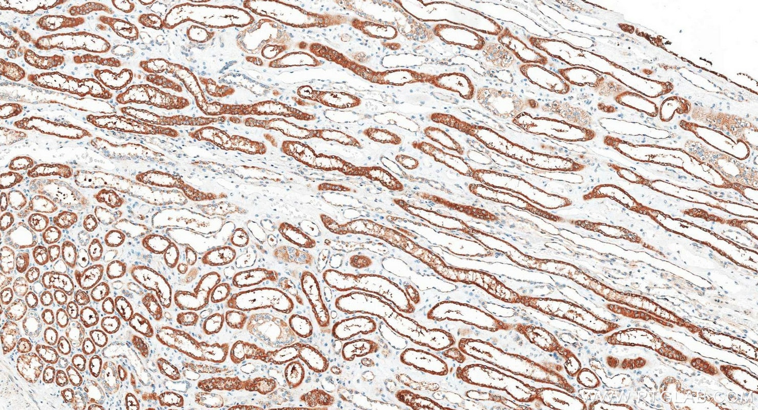 Immunohistochemistry (IHC) staining of human kidney tissue using Cathepsin V Polyclonal antibody (18442-1-AP)