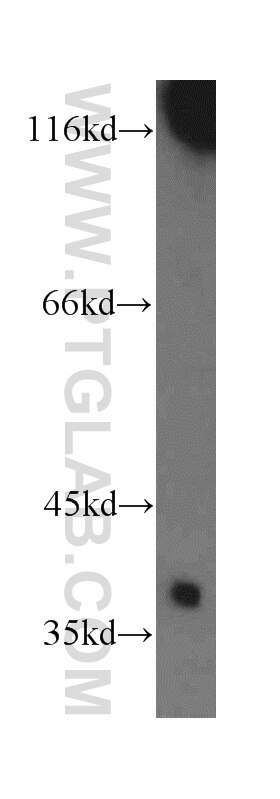 Western Blot (WB) analysis of human testis tissue using Cathepsin V Polyclonal antibody (18442-1-AP)