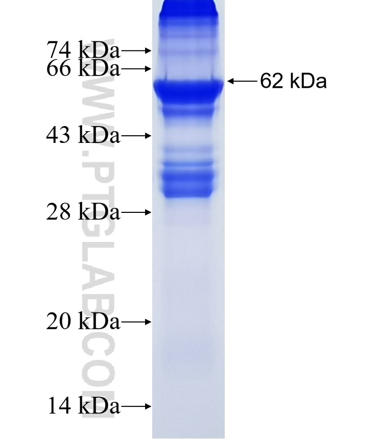 CTSL2 fusion protein Ag13284 SDS-PAGE
