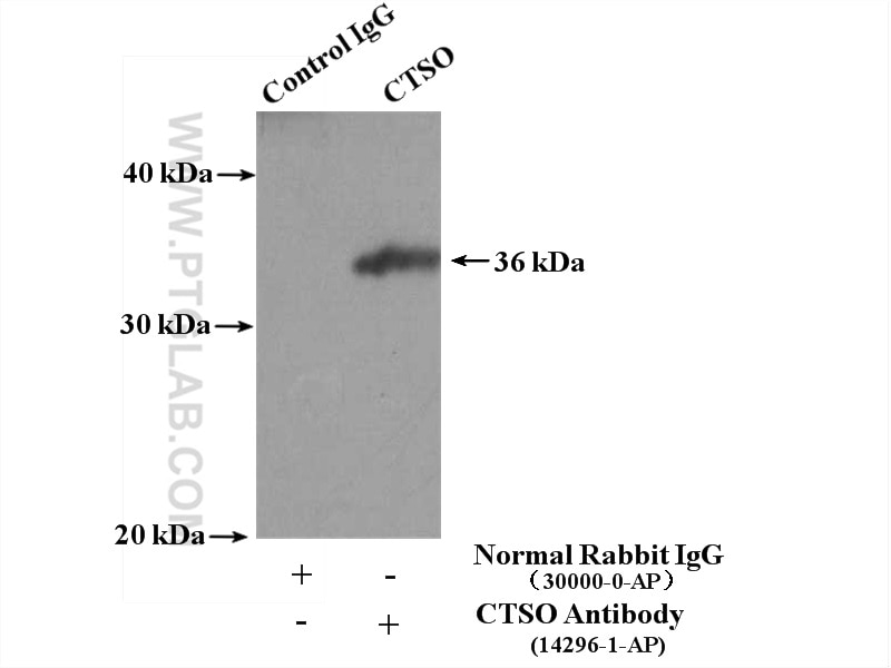 Immunoprecipitation (IP) experiment of HEK-293 cells using CTSO Polyclonal antibody (14296-1-AP)