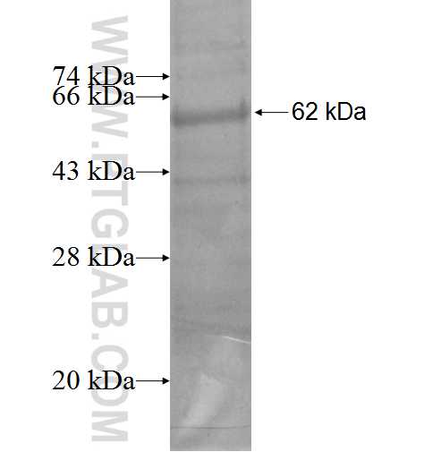 CTSO fusion protein Ag5651 SDS-PAGE