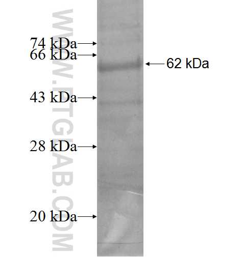 CTSO fusion protein Ag5651 SDS-PAGE