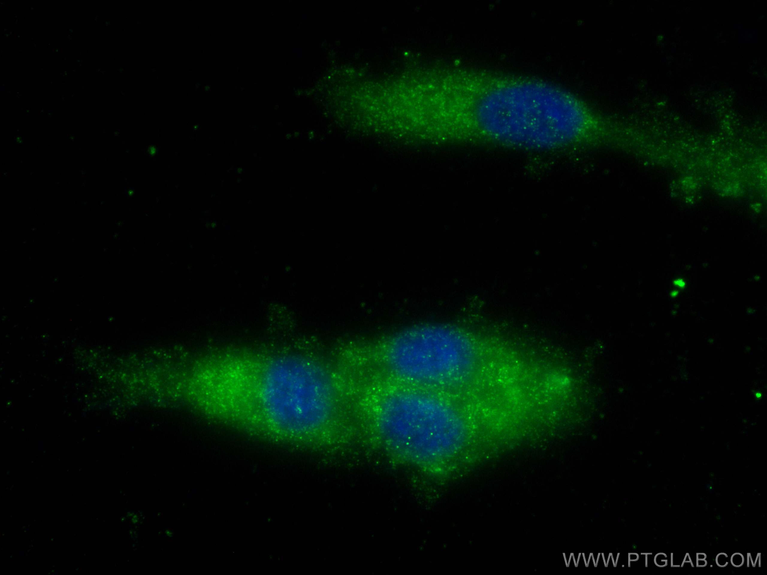 Immunofluorescence (IF) / fluorescent staining of U-87 MG cells using CTSS Polyclonal antibody (27538-1-AP)