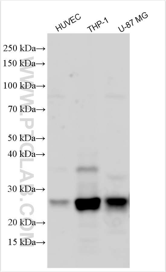 Western Blot (WB) analysis of various lysates using CTSS Polyclonal antibody (27538-1-AP)