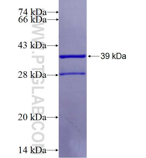 CTSS fusion protein Ag25881 SDS-PAGE
