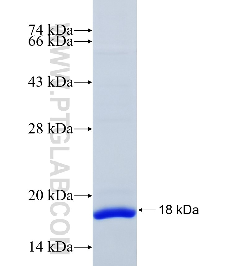 CTSS fusion protein Ag34579 SDS-PAGE