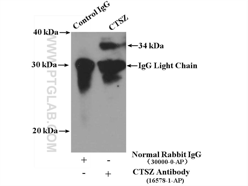 Immunoprecipitation (IP) experiment of HeLa cells using CTSZ Polyclonal antibody (16578-1-AP)