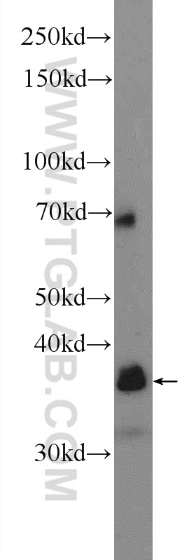 Western Blot (WB) analysis of mouse heart tissue using CTSZ Polyclonal antibody (16578-1-AP)