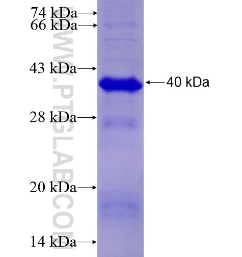 CTSZ fusion protein Ag10170 SDS-PAGE