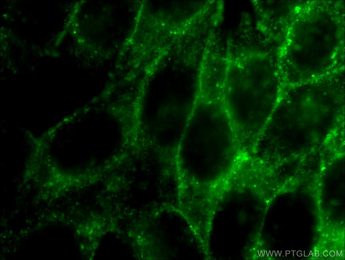 Immunofluorescence (IF) / fluorescent staining of HeLa cells using Cortactin Polyclonal antibody (11381-1-AP)