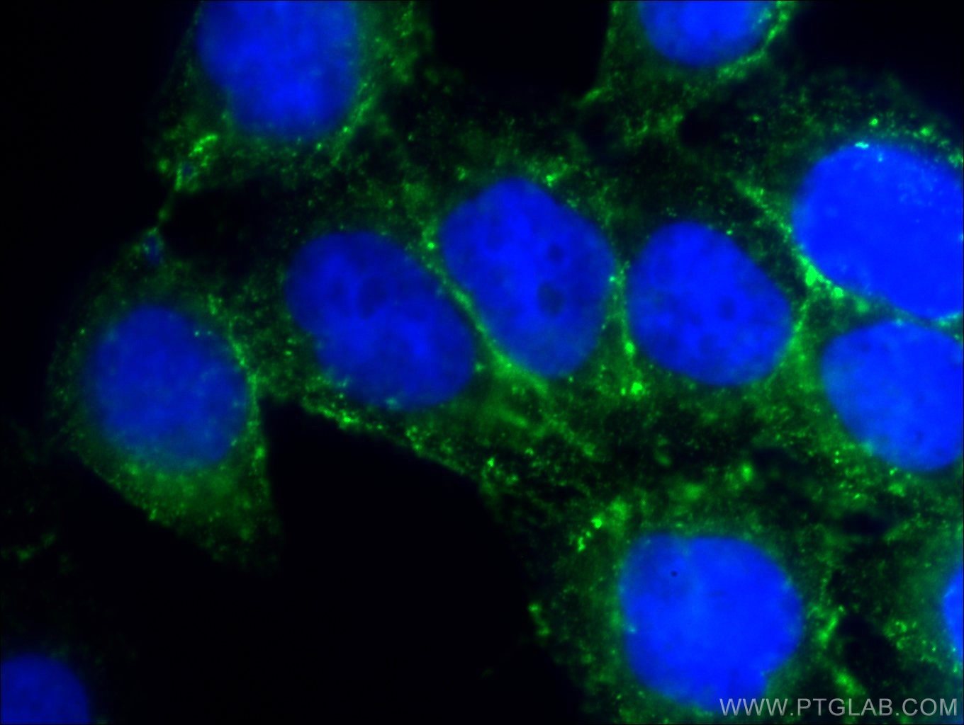 IF Staining of HeLa using 11381-1-AP