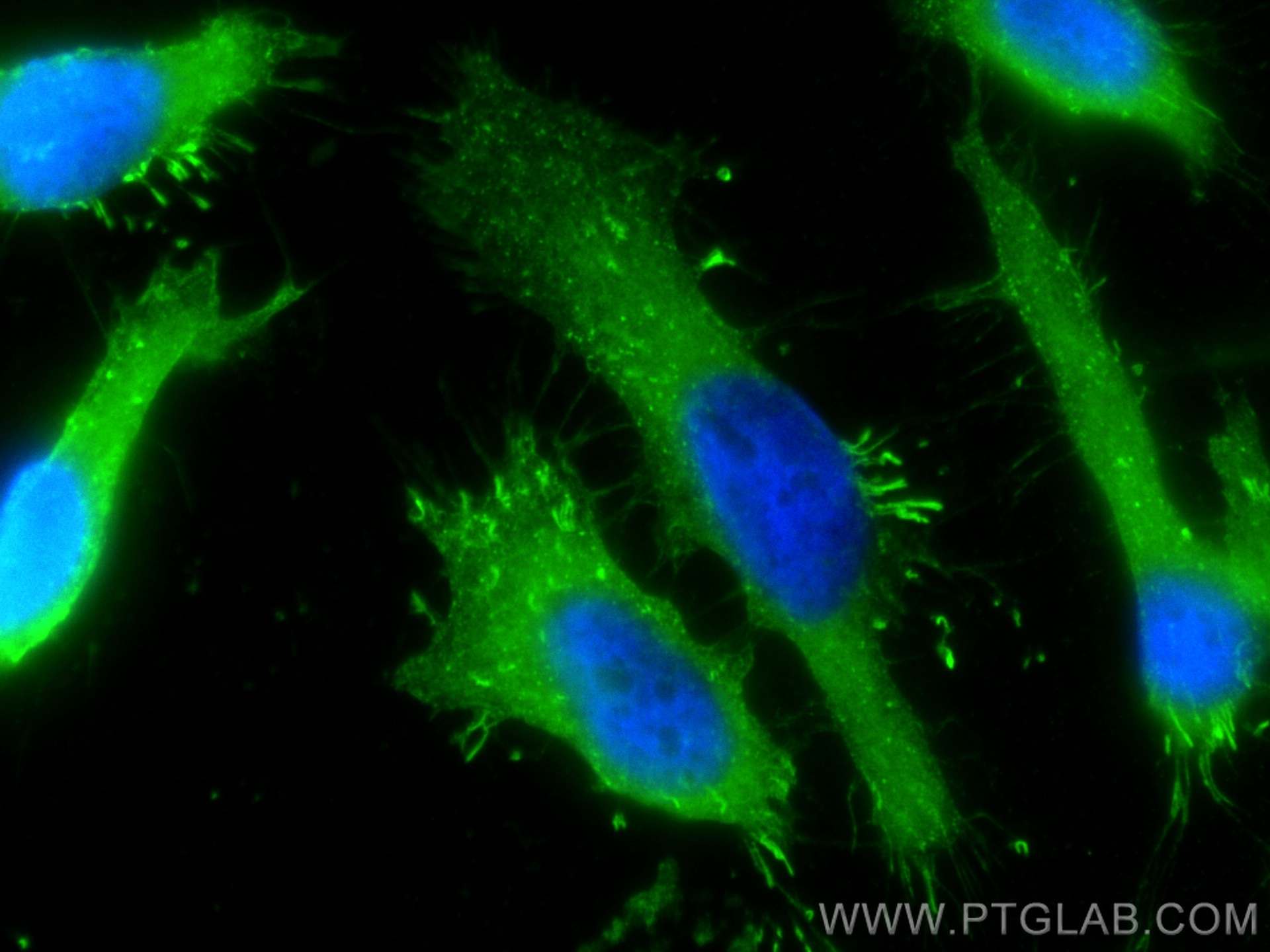 Immunofluorescence (IF) / fluorescent staining of HeLa cells using Cortactin Polyclonal antibody (11381-1-AP)