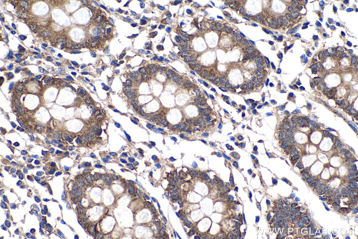 Immunohistochemistry (IHC) staining of human colon tissue using Cortactin Polyclonal antibody (11381-1-AP)