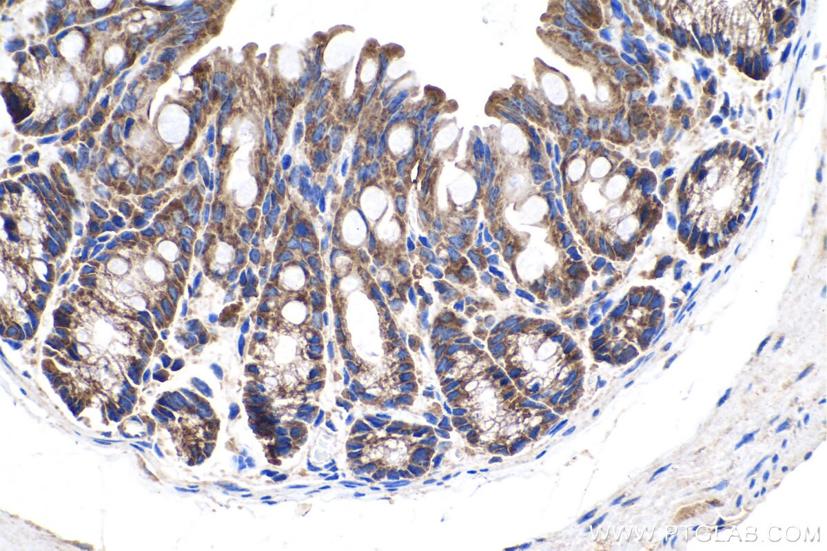 Immunohistochemistry (IHC) staining of mouse colon tissue using Cortactin Polyclonal antibody (11381-1-AP)