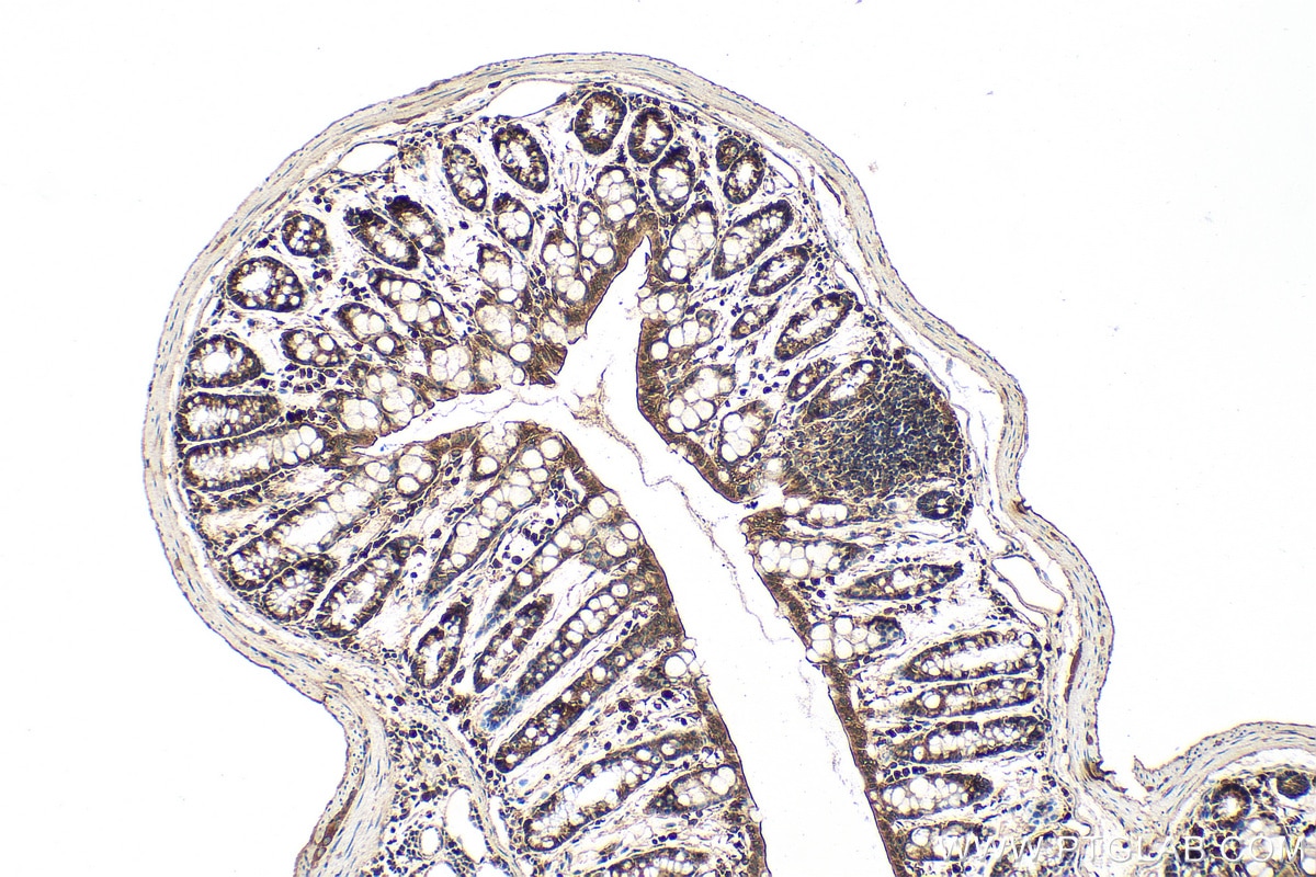 Immunohistochemistry (IHC) staining of mouse colon tissue using Cortactin Polyclonal antibody (11381-1-AP)