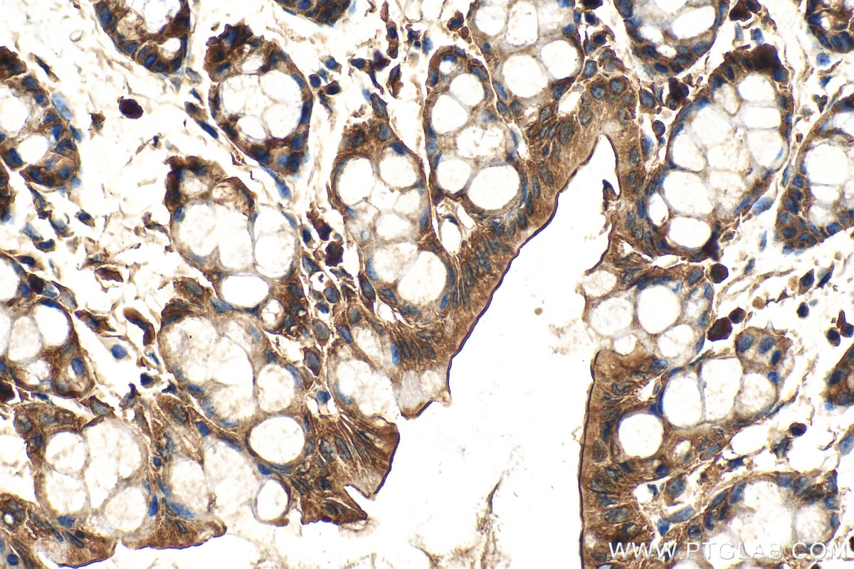 Immunohistochemistry (IHC) staining of mouse colon tissue using Cortactin Polyclonal antibody (11381-1-AP)