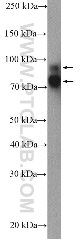 Western Blot (WB) analysis of A549 cells using Cortactin Polyclonal antibody (11381-1-AP)