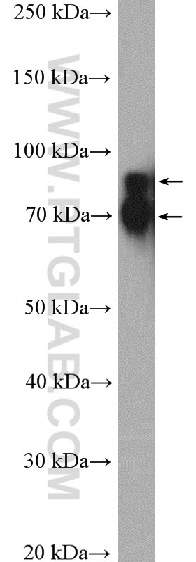 Western Blot (WB) analysis of MCF-7 cells using Cortactin Polyclonal antibody (11381-1-AP)