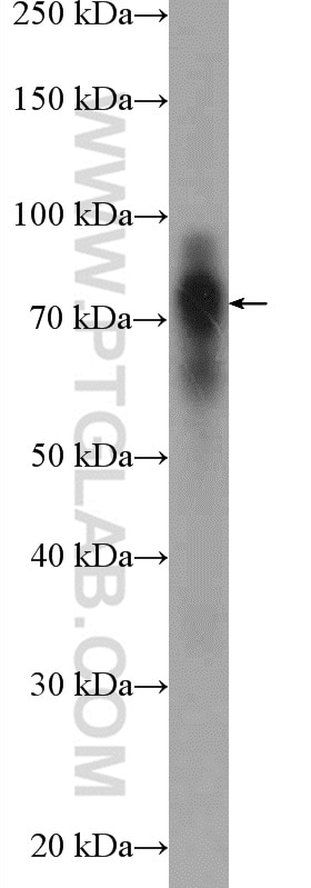 Western Blot (WB) analysis of HT-1080 cells using Cortactin Polyclonal antibody (11381-1-AP)