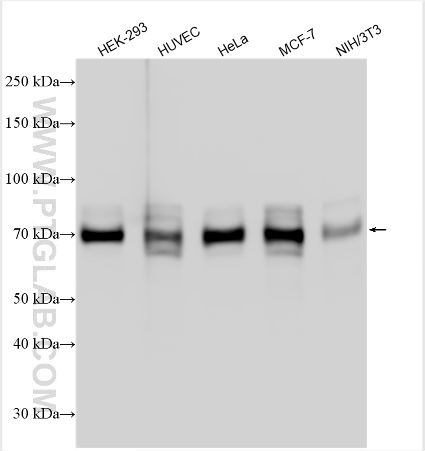 Western Blot (WB) analysis of various lysates using Cortactin Polyclonal antibody (11381-1-AP)