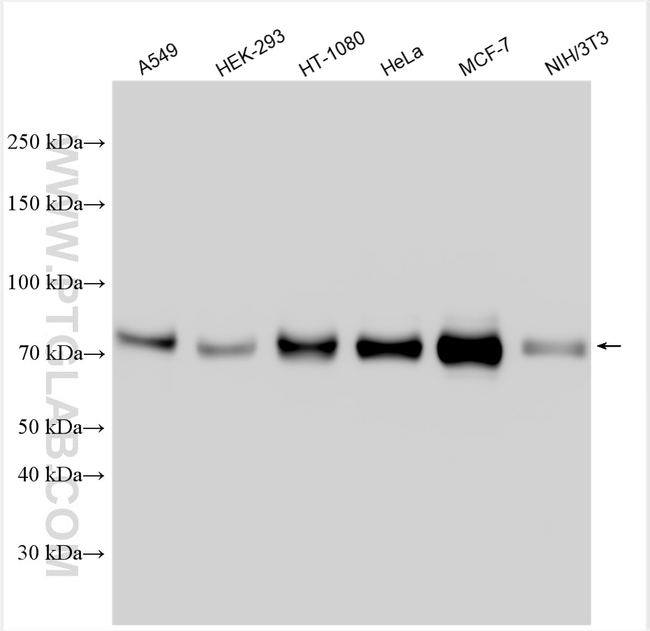Western Blot (WB) analysis of various lysates using Cortactin Polyclonal antibody (11381-1-AP)