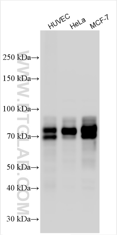 Western Blot (WB) analysis of various lysates using Cortactin Polyclonal antibody (11381-1-AP)