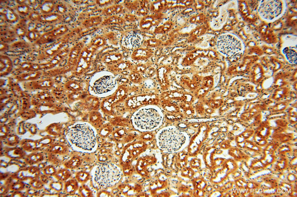 Immunohistochemistry (IHC) staining of human kidney tissue using CTTNBP2 Polyclonal antibody (17893-1-AP)