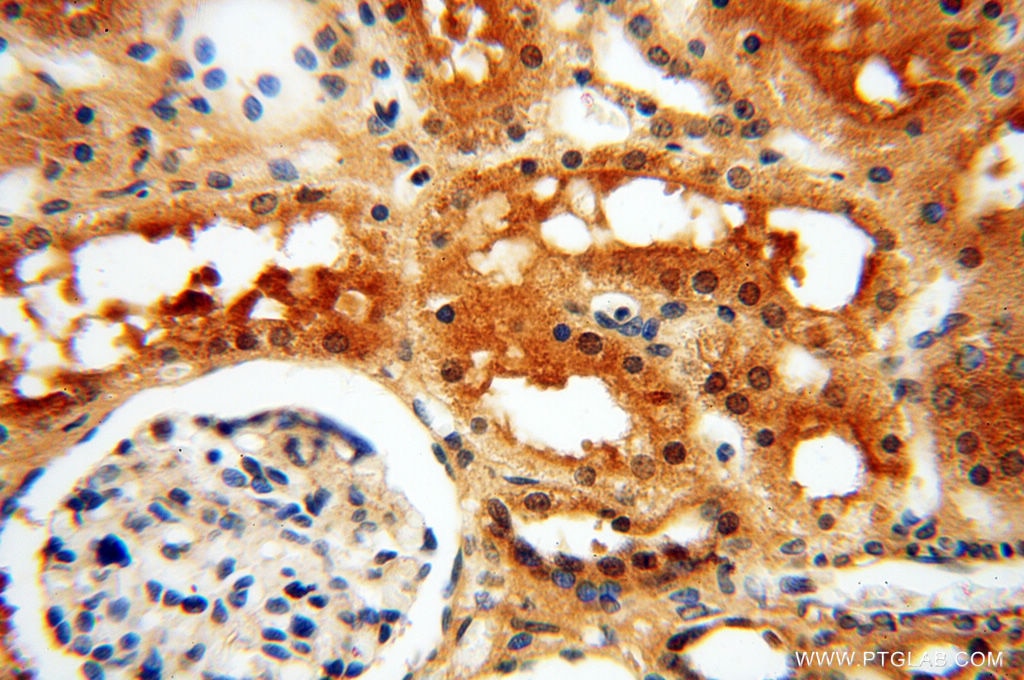 IHC staining of human kidney using 17893-1-AP