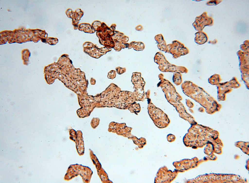 Immunohistochemistry (IHC) staining of human placenta tissue using CTTNBP2 Polyclonal antibody (17893-1-AP)