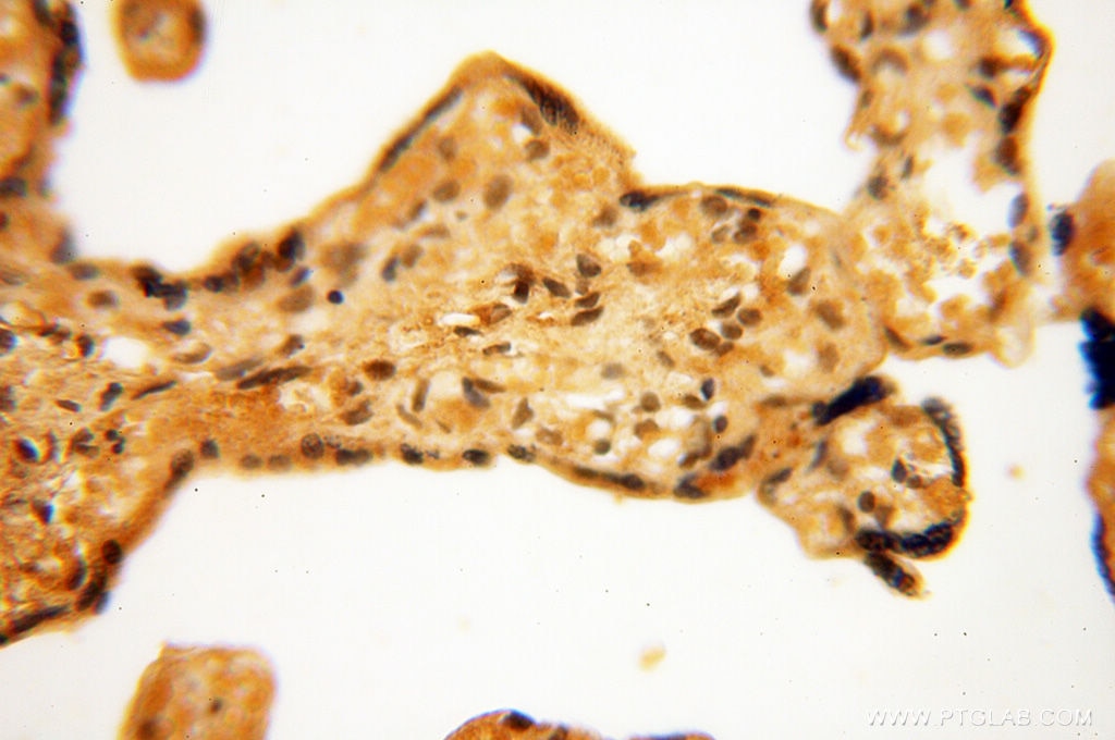 IHC staining of human placenta using 17893-1-AP