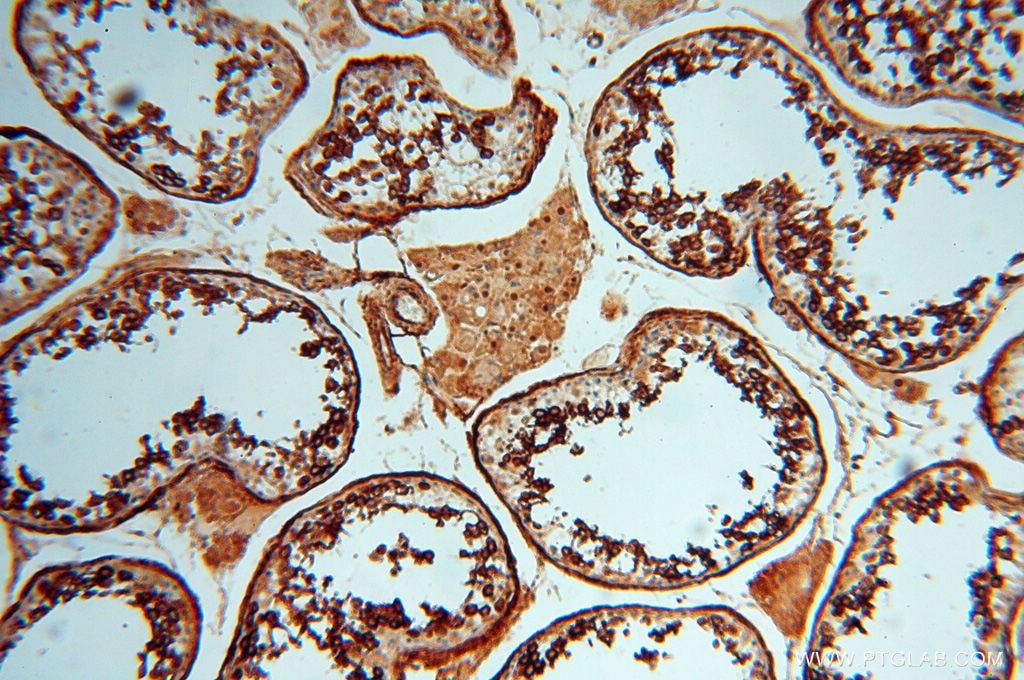 Immunohistochemistry (IHC) staining of human testis tissue using CTTNBP2 Polyclonal antibody (17893-1-AP)