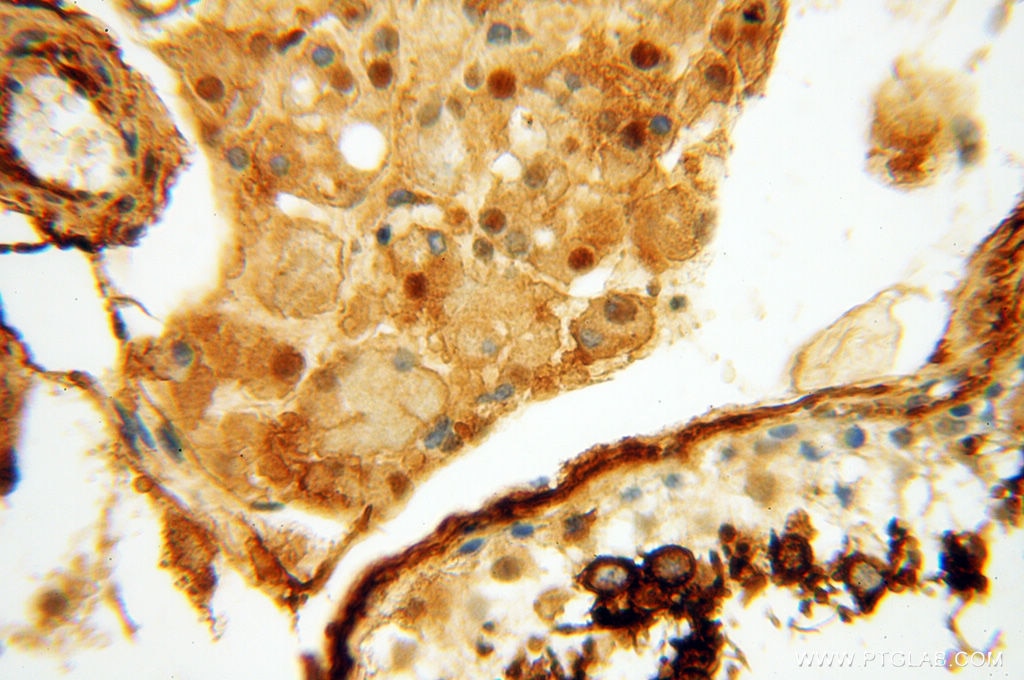 Immunohistochemistry (IHC) staining of human testis tissue using CTTNBP2 Polyclonal antibody (17893-1-AP)