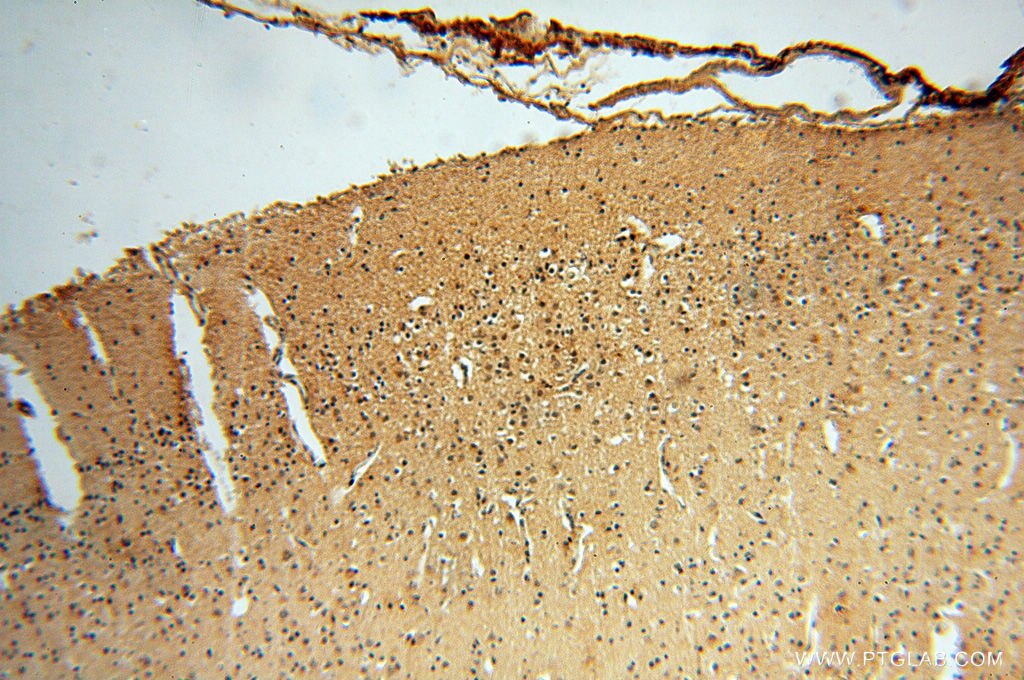 Immunohistochemistry (IHC) staining of human brain tissue using CTTNBP2 Polyclonal antibody (17893-1-AP)