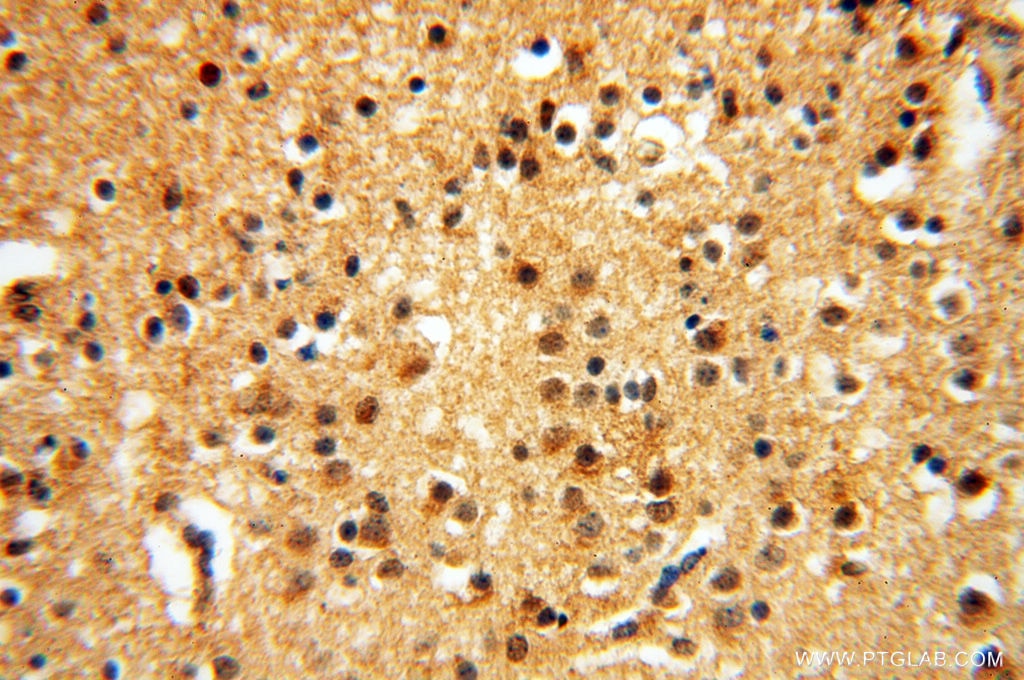 Immunohistochemistry (IHC) staining of human brain tissue using CTTNBP2 Polyclonal antibody (17893-1-AP)