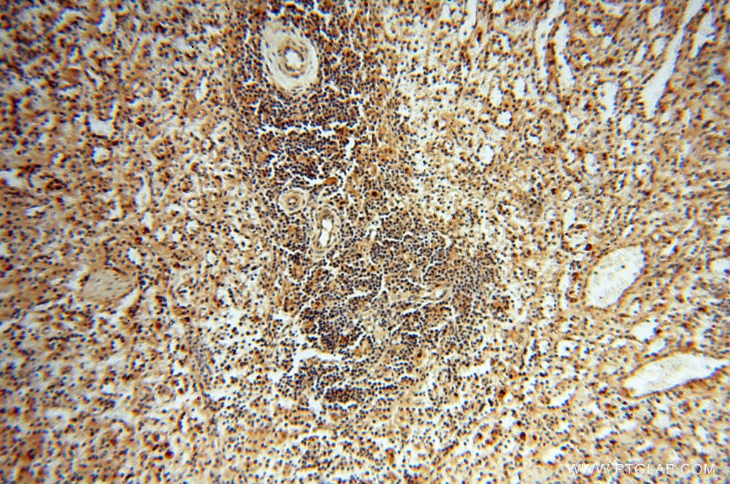 Immunohistochemistry (IHC) staining of human spleen tissue using CTTNBP2 Polyclonal antibody (17893-1-AP)