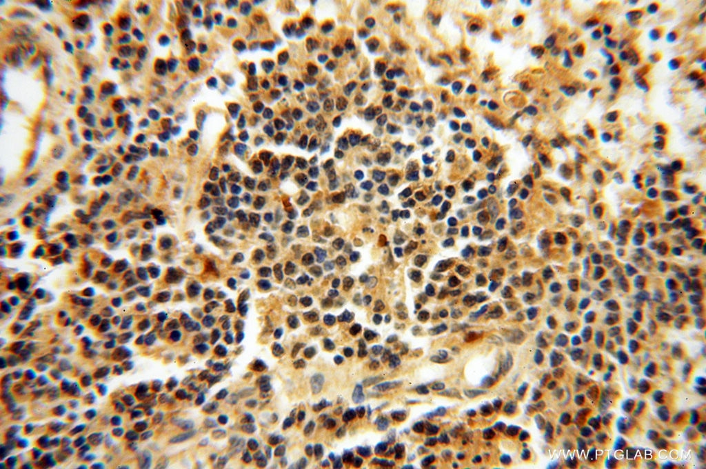 Immunohistochemistry (IHC) staining of human spleen tissue using CTTNBP2 Polyclonal antibody (17893-1-AP)