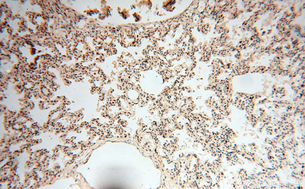 Immunohistochemistry (IHC) staining of human lung tissue using CTTNBP2 Polyclonal antibody (17893-1-AP)